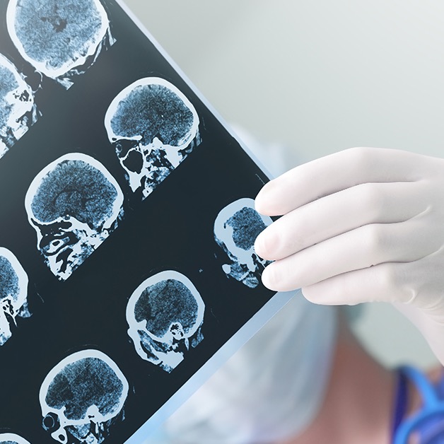 Gloved hand holding brain scan images