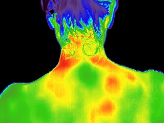 Neck and shoulders thermal image after session