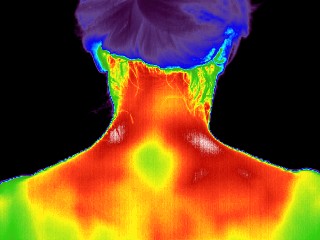 Neck and shoulders thermal image before session