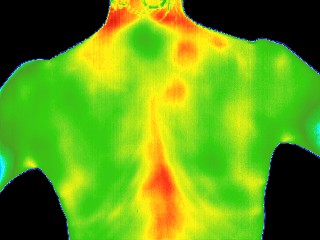 Upper back thermal image after session