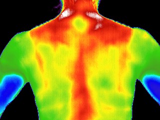 Upper back thermal image before session